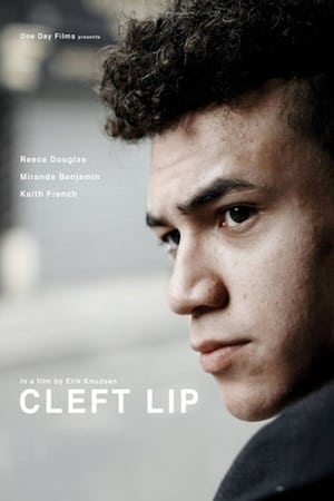 donde ver cleft lip