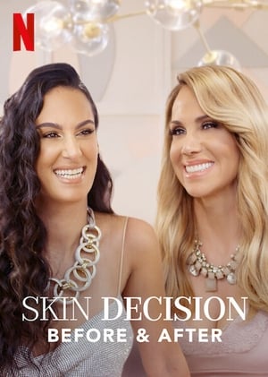 donde ver skin decision: before and after